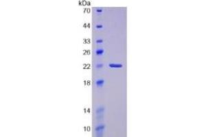 SDS-PAGE of Protein Standard from the Kit (Highly purified E. (PTGDS Kit ELISA)