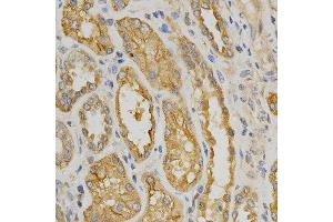 Immunohistochemistry of paraffin-embedded human kidney using NOX4 antibody at dilution of 1:200 (x400 lens) (NADPH Oxidase 4 anticorps)