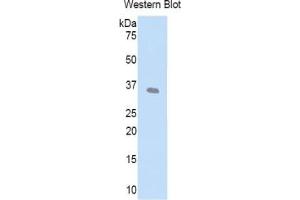 WB of Protein Standard: different control antibodies against Highly purified E.