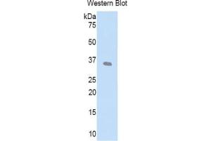 WB of Protein Standard: different control antibodies against Highly purified E. (LEFTY1 Kit ELISA)