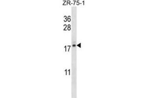 Western Blotting (WB) image for anti-Transition Protein 2 (During Histone To Protamine Replacement) (TNP2) antibody (ABIN2996959) (TNP2 anticorps)