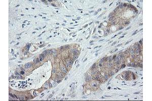 Image no. 3 for anti-Chromosome 2 Open Reading Frame 62 (C2orf62) antibody (ABIN1497054) (C2orf62 anticorps)