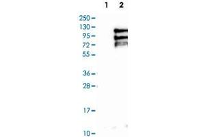 Western Blot analysis of Lane 1: negative control (vector only transfected HEK293T cell lysate) and Lane 2: over-expression lysate (co-expressed with a C-terminal myc-DDK tag in mammalian HEK293T cells) with TPX2 polyclonal antibody . (TPX2 anticorps)