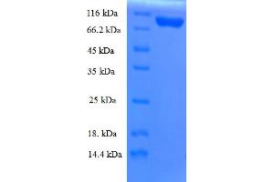 SDS-PAGE (SDS) image for Karyopherin (Importin) beta 1 (KPNB1) (AA 1-876), (full length) protein (His tag) (ABIN5709821)