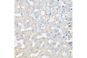 Immunohistochemistry of paraffin-embedded human liver injury using ARL6 antibody. (ARL6 anticorps  (AA 1-186))