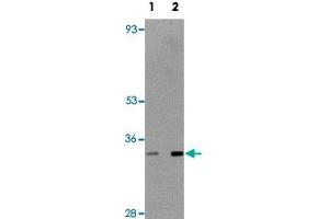 Western blot analysis of rat thymus tissue with TMEM38B polyclonal antibody  at (Lane 1) 1 and (Lane 2) 2 ug/mL dilution. (TMEM38B anticorps  (C-Term))