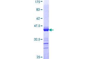 Image no. 1 for Tight Junction Protein 2 (Zona Occludens 2) (TJP2) (AA 121-218) protein (GST tag) (ABIN1322816)