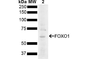 Western blot analysis of Rat Liver showing detection of 69. (FOXO1 anticorps  (AA 410-520) (HRP))