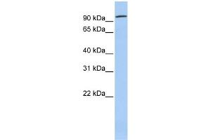 WB Suggested Anti-ZNF777 Antibody Titration:  0. (ZNF777 anticorps  (Middle Region))
