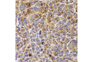 Immunohistochemistry of paraffin-embedded mouse cancer using UBE2R2 antibody (ABIN5975512) at dilution of 1/100 (40x lens). (UBE2R2 anticorps)