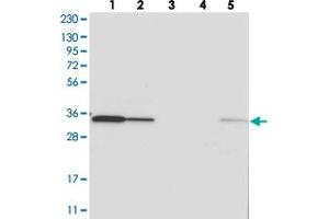 Western blot analysis of Lane 1: RT-4, Lane 2: U-251 MG, Lane 3: Human Plasma, Lane 4: Liver, Lane 5: Tonsil with C1orf74 polyclonal antibody  at 1:250-1:500 dilution. (C1ORF74 anticorps)