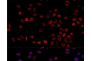 Immunofluorescence analysis of 293T cells using HNRNPH1 Polyclonal Antibody at dilution of 1:100 (40x lens).