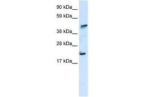 WB Suggested Anti-ZNFN1A5 Antibody Titration: 0. (IKZF5 anticorps  (N-Term))