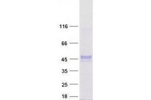 Validation with Western Blot