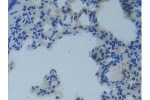 Detection of MMP14 in Mouse Lung Tissue using Polyclonal Antibody to Matrix Metalloproteinase 14 (MMP14)