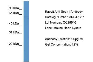 Western Blotting (WB) image for anti-Selenoprotein N, 1 (SEPN1) (C-Term) antibody (ABIN617009) (SEPN1 anticorps  (C-Term))