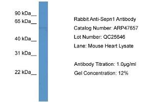 Western Blotting (WB) image for anti-Selenoprotein N, 1 (SEPN1) (C-Term) antibody (ABIN2783071) (SEPN1 anticorps  (C-Term))