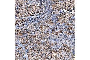 IHC analysis of SCO1 using anti-SCO1 antibody (ABIN7600609). (SCO1 anticorps  (AA 21-301))