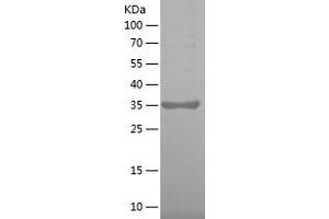 Western Blotting (WB) image for Coagulation Factor II (thrombin) Receptor-Like 1 (F2RL1) (AA 348-397) protein (His-IF2DI Tag) (ABIN7122416)