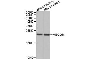 Western blot analysis of extracts of various cell lines, using MECOM antibody (ABIN5973314) at 1/1000 dilution. (MECOM anticorps)