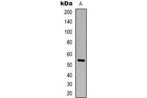 Western blot analysis of TIGD3 expression in Jurkat (A) whole cell lysates. (TIGD3 anticorps  (C-Term))