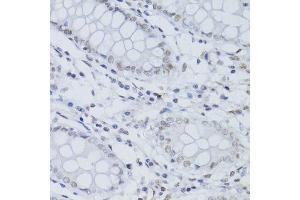 Immunohistochemistry of paraffin-embedded human colon using SNRNP70 antibody.
