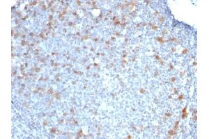 Formalin-fixed, paraffin-embedded human Tonsil stained with CDC20 Monoclonal Antibody (CDC20/1102) (CDC20 anticorps)