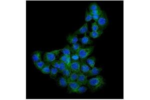 IF analysis of Syndecan-1 using anti-Syndecan-1 antibody (ABIN3043430).