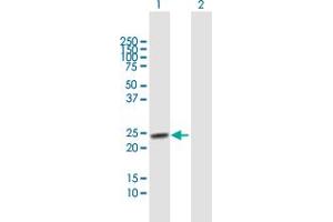 Western Blot analysis of TSPYL4 expression in transfected 293T cell line by TSPYL4 MaxPab polyclonal antibody. (TSPY-Like 4 anticorps  (AA 1-211))