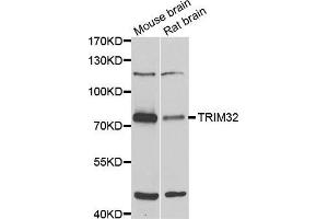 Western blot analysis of extracts of various cell lines, using TRIM32 antibody (ABIN5975475) at 1/1000 dilution. (TRIM32 anticorps)