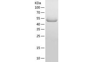 Western Blotting (WB) image for Matrix Metallopeptidase 14 (Membrane-inserted) (MMP14) (AA 1-501) protein (His tag) (ABIN7123856) (MMP14 Protein (AA 1-501) (His tag))