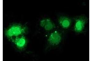 Anti-NHEJ1 mouse monoclonal antibody (ABIN2453927) immunofluorescent staining of COS7 cells transiently transfected by pCMV6-ENTRY NHEJ1 (RC203393). (NHEJ1 anticorps)