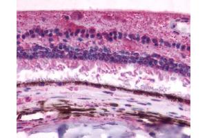 Anti-RGR antibody IHC of human eye, retina. (RGR anticorps  (Cytoplasmic Domain))