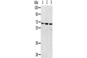 Western Blotting (WB) image for anti-Solute Carrier Family 5 (Sodium/glucose Cotransporter), Member 9 (SLC5A9) antibody (ABIN2427251) (SLC5A9 anticorps)