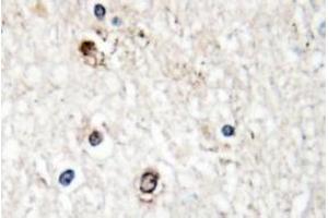 Image no. 1 for anti-NGFI-A Binding Protein 2 (EGR1 Binding Protein 2) (NAB2) antibody (ABIN317614) (NAB2 anticorps)