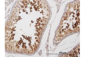 Immunoperoxidase of purified MaxPab antibody to YBX2 on formalin-fixed paraffin-embedded human testis.