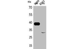 Western Blot analysis of H460 K562 cells using Cathepsin L Polyclonal Antibody (Cathepsin L anticorps  (Internal Region))