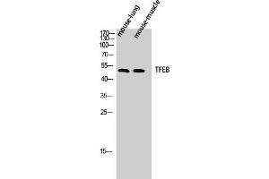 Western Blot analysis of Mouse-lung Mouse-muscle cells using TFEB Polyclonal Antibody diluted at 1:500. (TFEB anticorps  (AA 10-90))