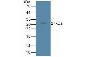 Mouse Capture antibody from the kit in WB with Positive Control: Mouse testis lysate.