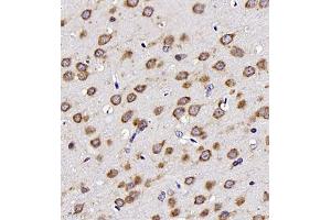 Immunohistochemistry analysis of paraffin embedded rat brain using Neurotensin (ABIN7074827) at dilution of 1: 400