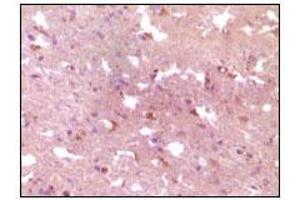 Immunohistochemical analysis of paraffin-embedded human Alzheimer brain tissue, showing cytoplasmic localization using APP mouse mAb with DAB staining. (APP anticorps)