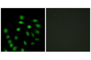 Immunofluorescence analysis of HepG2 cells, using SCAND1 antibody. (SCAND1 anticorps  (Internal Region))