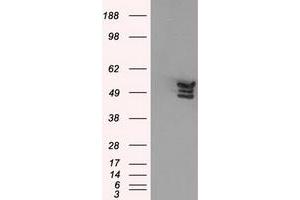 Western Blotting (WB) image for anti-Annexin A11 (ANXA11) antibody (ABIN1496647) (Annexin A11 anticorps)