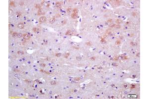 Formalin-fixed and paraffin embedded rat brain tissue labeled with RABBIT ANTI-SAHH POLYCLONAL ANTIBODY, Unconjugated (ABIN708611) at 1:200 followed by conjugation to the secondary antibody and DAB staining. (AHCY anticorps  (AA 25-125))