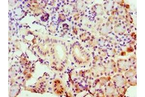 Immunohistochemistry of paraffin-embedded human pancreatic tissue using ABIN7143157 at dilution of 1:100 (ASCC3 anticorps  (AA 1-111))