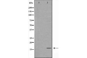 Western blot analysis of TOMM20 expression in K562 cells,The lane on the left is treated with the antigen-specific peptide. (TOMM20 anticorps  (Internal Region))