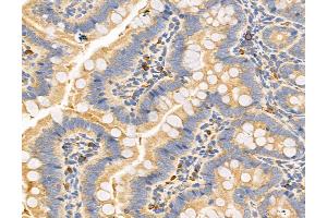 ABIN6263342 and ABIN6272964 at 1/100 staining Rat colon tissue by IHC-P.