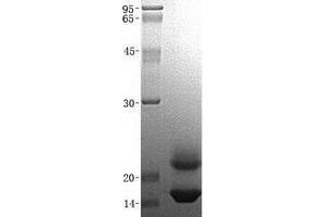 Validation with Western Blot (CST6 Protein (His tag))