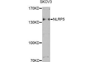 Western blot analysis of extracts of SKOV3 cells, using NLRP5 Antibody (ABIN6003618) at 1/1000 dilution.