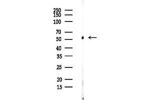 Western blot analysis of lysates from Rat brain, using TUA Antibody at 1/1000 dilution.